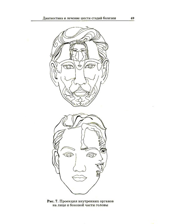 Диагностика и лечение шести стадий болезни