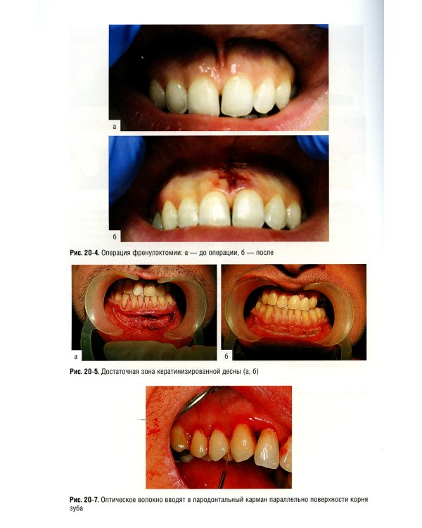 Пародонтология. Национальное руководство