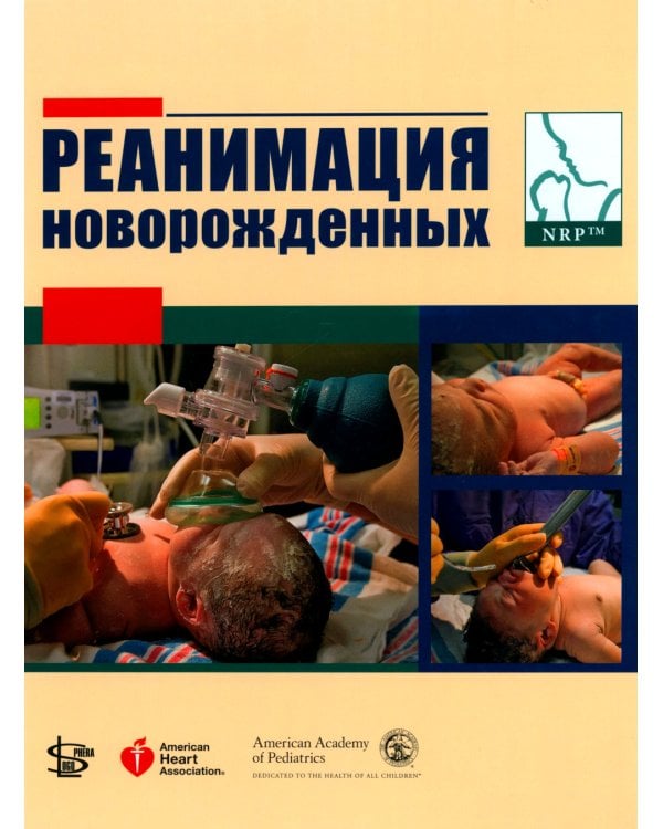 Реанимация новорожденных