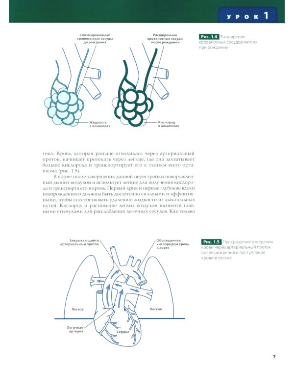 Реанимация новорожденных