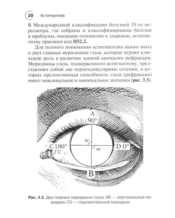 Астигматизм. 2-е изд., перераб. и доп