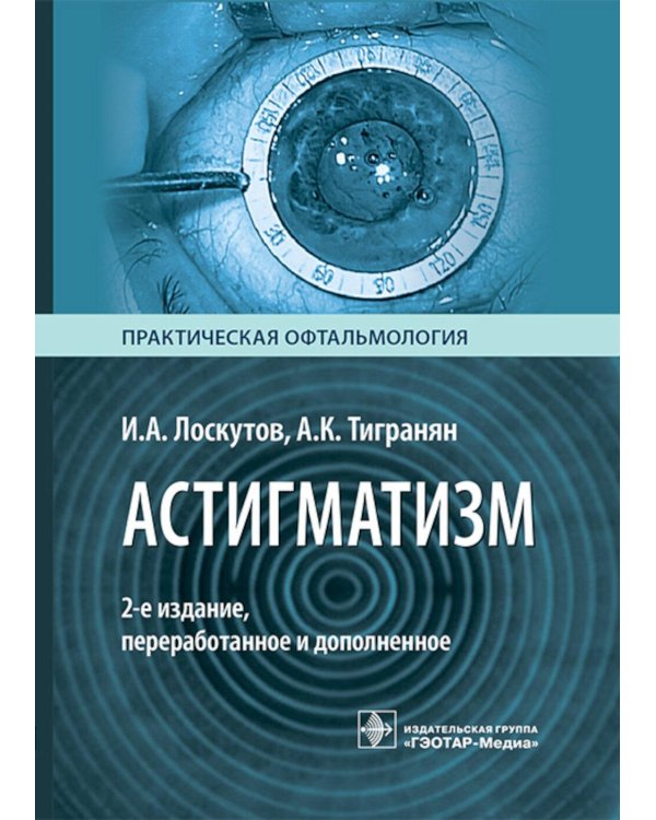 Астигматизм. 2-е изд., перераб. и доп