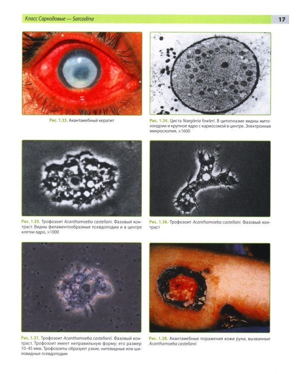 Атлас по медицинской паразитологии: Учебное пособие