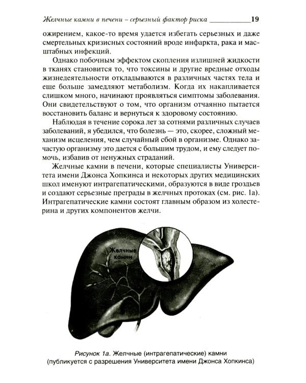 Удивительное очищение печени и желчного пузыря