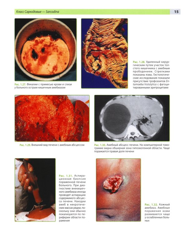 Атлас по медицинской паразитологии: Учебное пособие