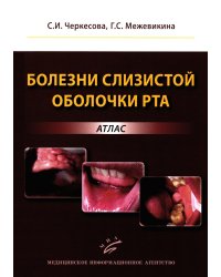 Болезни слизистой оболочки рта: атлас