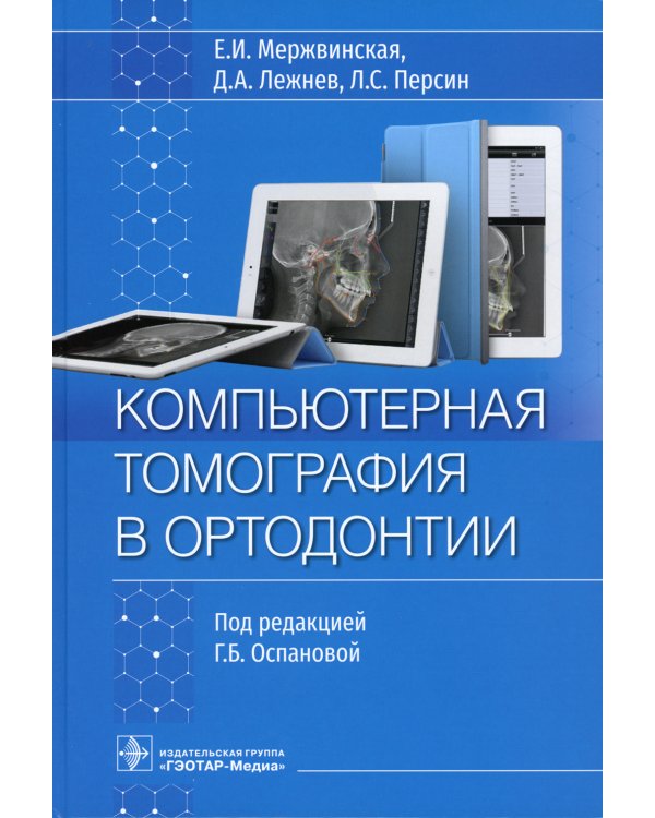 Компьютерная томография в ортодонтии