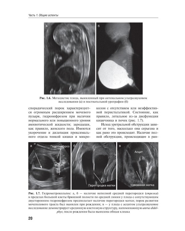 Детская урология. Современные операционные методики: от внутриутробного периода развития до пубертата