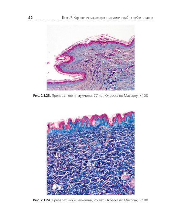 Комплексная оценка возрастных изменений при судебно-медицинской идентификации личности: Учебное пособие