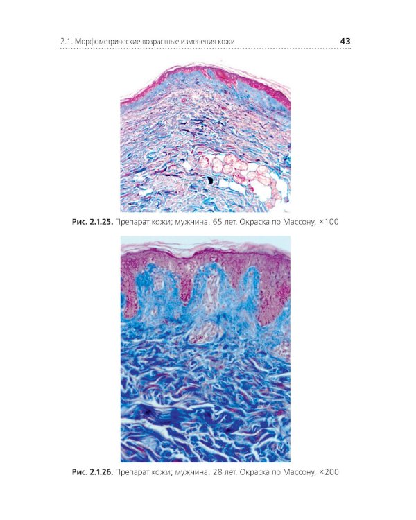 Комплексная оценка возрастных изменений при судебно-медицинской идентификации личности: Учебное пособие