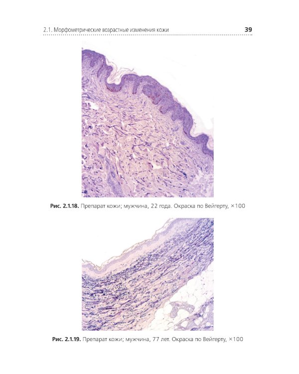 Комплексная оценка возрастных изменений при судебно-медицинской идентификации личности: Учебное пособие