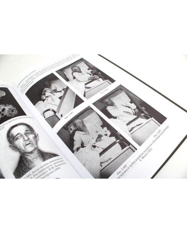 Атлас по психиатрии. Общая психопатология. В 2-х кн