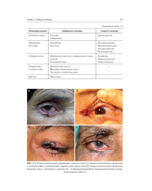 Хирургическая офтальмоонкология
