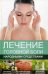 Лечение головной боли народными средствами