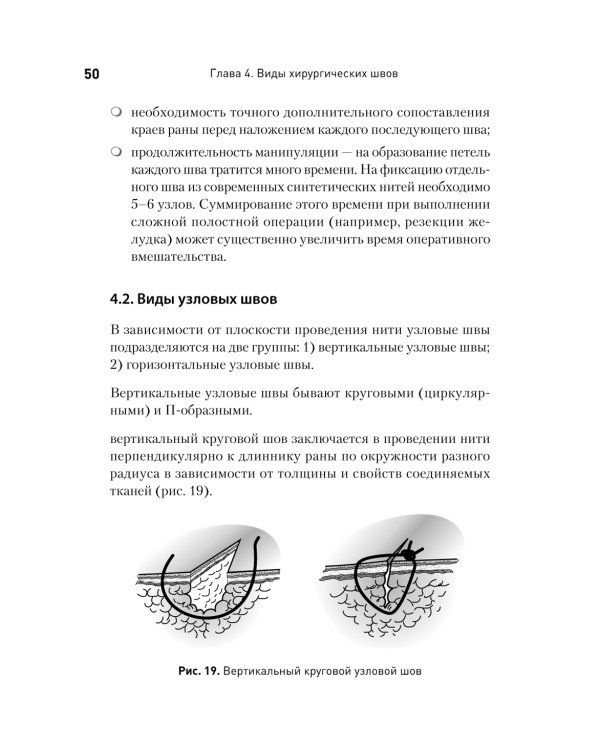 Хирургический шов. 3-е изд., обновлен