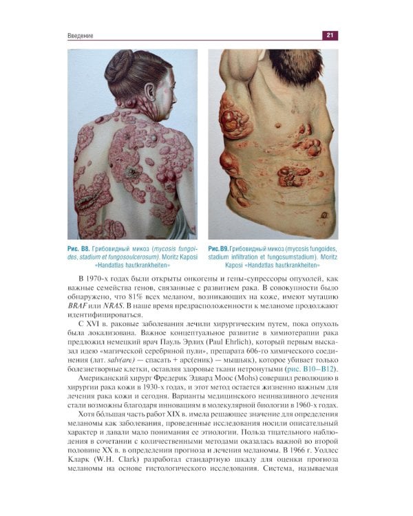 Дерматоонкопатология: иллюстрированное руководство для врачей
