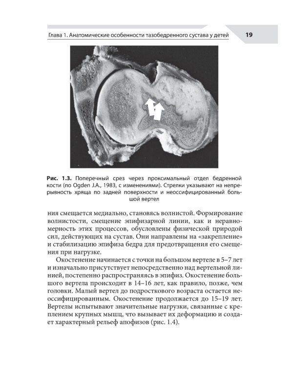 Хирургия тазобедренного сустава у детей