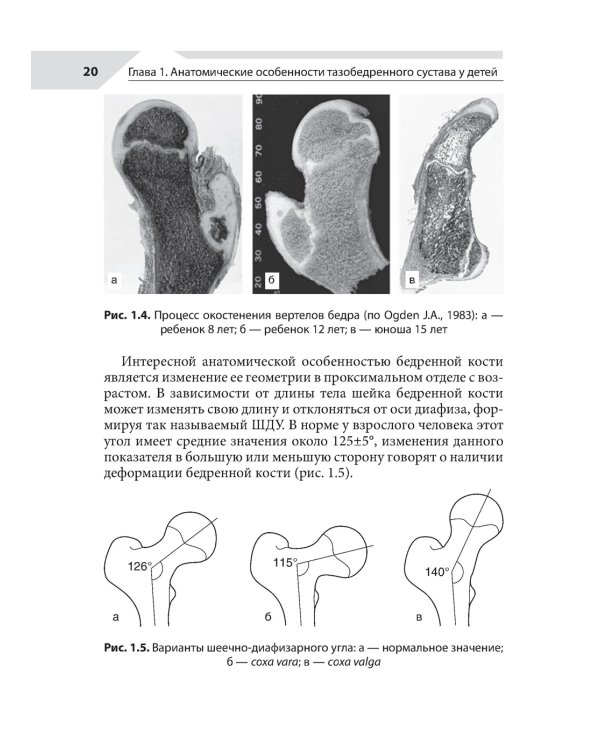 Хирургия тазобедренного сустава у детей