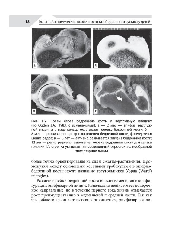 Хирургия тазобедренного сустава у детей