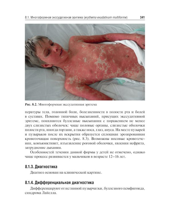 Дерматовенерология: Учебник. 2-е изд., перераб. и доп