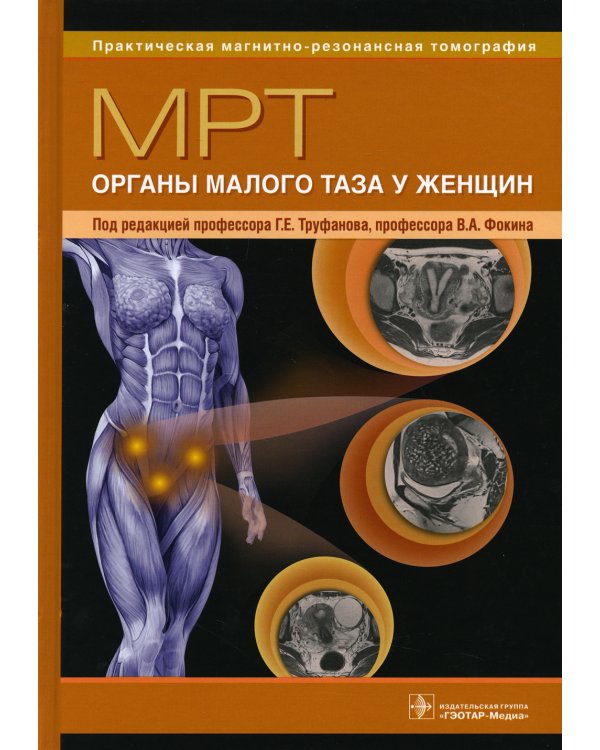 МРТ. Органы малого таза у женщин: руководство для врачей