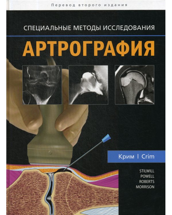 Артрография. Специальные методы исследования