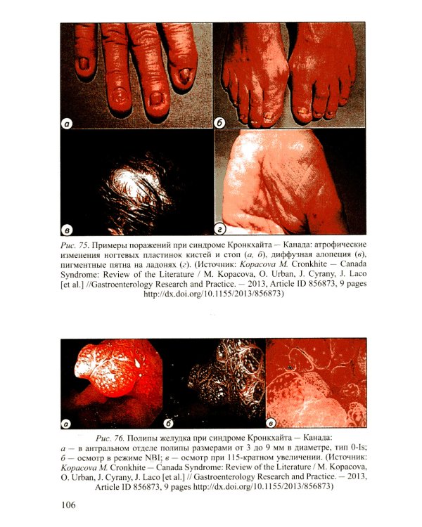 Доброкачественные опухоли желудка. Ч. 1: Эпителиальные опухоли и опухолеподобные поражения: Учебно-методическое пособие. 2-е изд., испр. и доп
