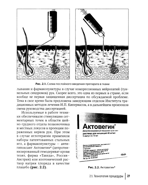 Биопунктурная стимуляция при дорсопатиях: руководство для врачей. 3-е изд., перераб. и доп
