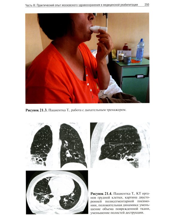 Медицинская реабилитация при COVID-19. Руководство для врачей.
