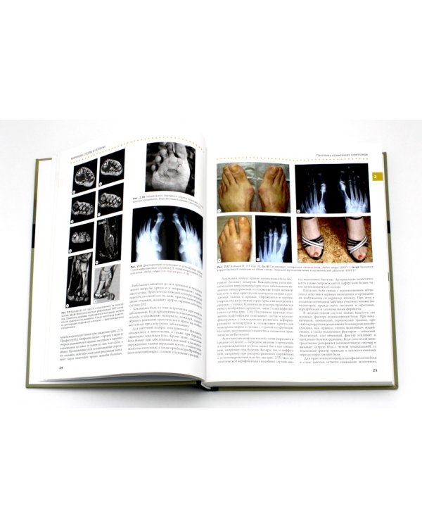 Хирургия стопы и голени. Практическое руководство