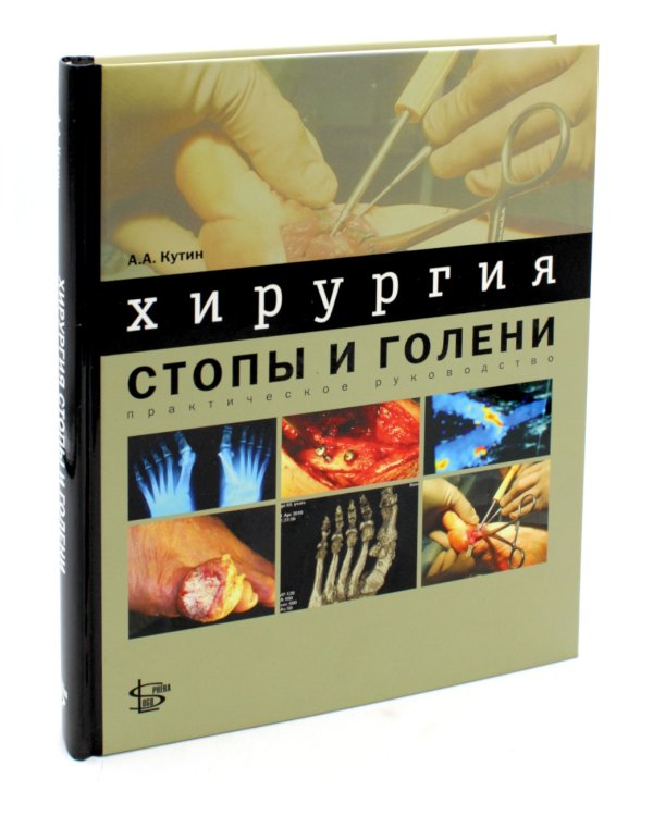 Хирургия стопы и голени. Практическое руководство