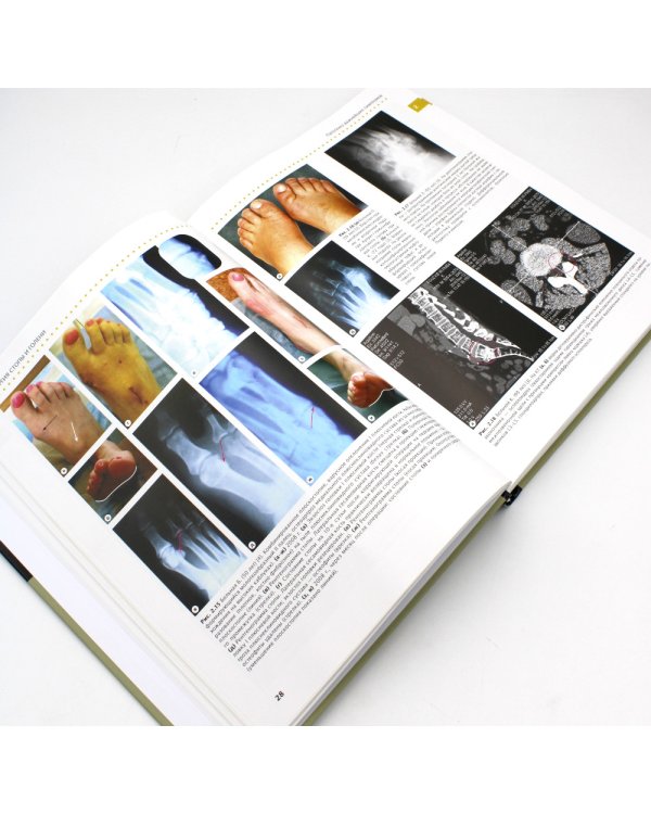 Хирургия стопы и голени. Практическое руководство