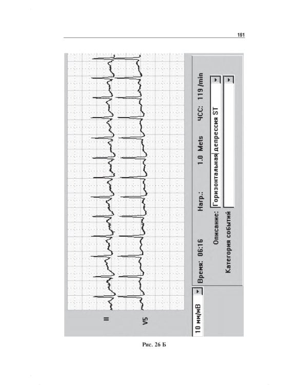 Нагрузочные ЭКГ-тесты: 10 шагов к практике: Учебное пособие. 7-е изд