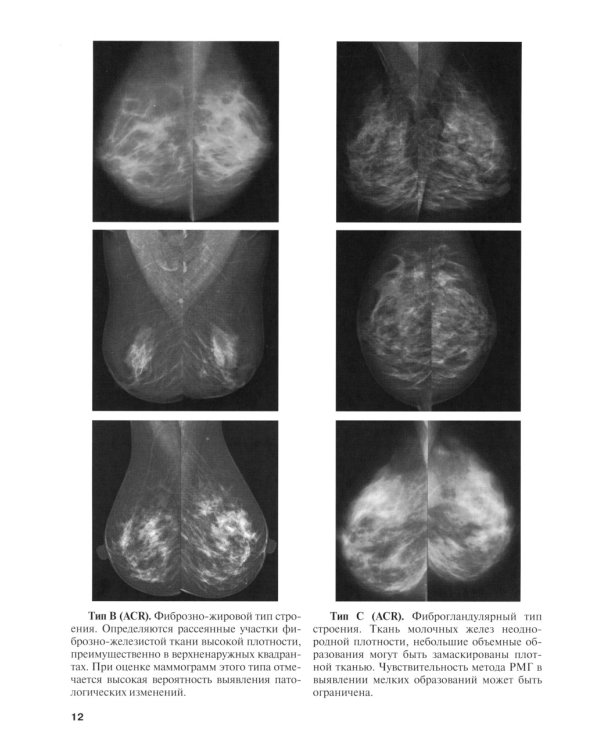 Применение международной классификации BI-RADS в маммологической практике. Руководство для врачей. 4-е изд