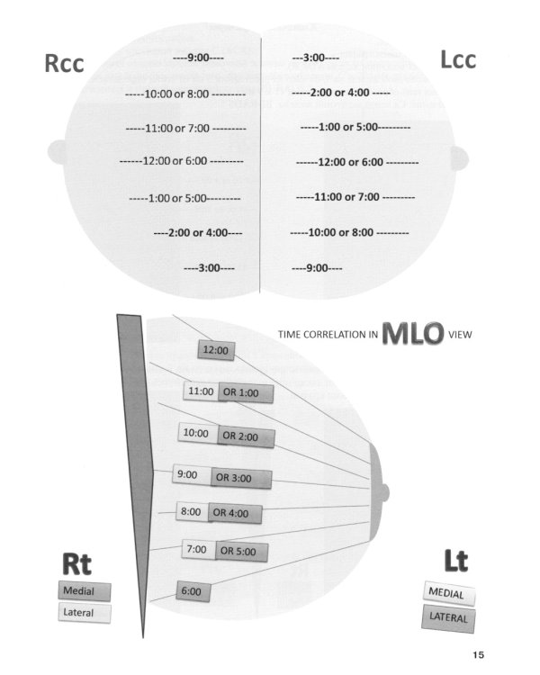Применение международной классификации BI-RADS в маммологической практике. Руководство для врачей. 4-е изд