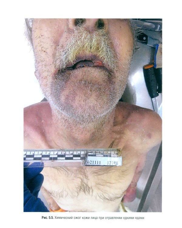 Выполнение лабораторных и инструментальных исследований при производстве судебно-медицинских экспертиз: Учебник