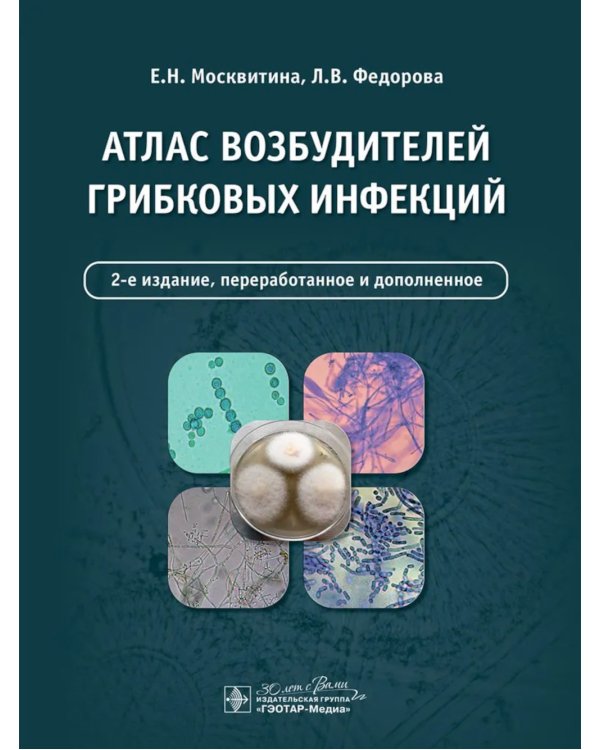 Атлас возбудителей грибковых инфекций. 2-е изд., перераб. и доп
