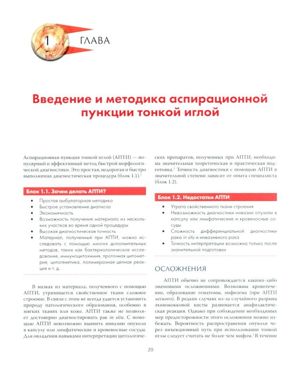 Аспирационная пункция тонкой иглой. Трактовка результатов и диагностические проблемы