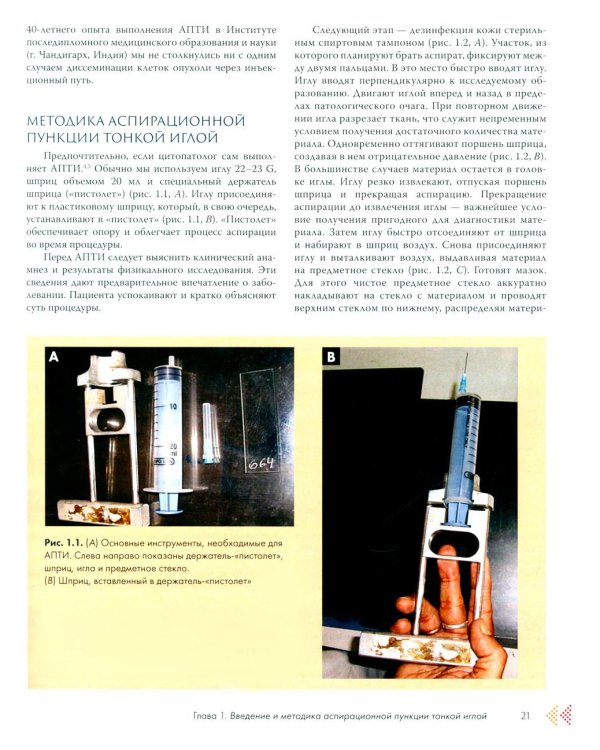 Аспирационная пункция тонкой иглой. Трактовка результатов и диагностические проблемы