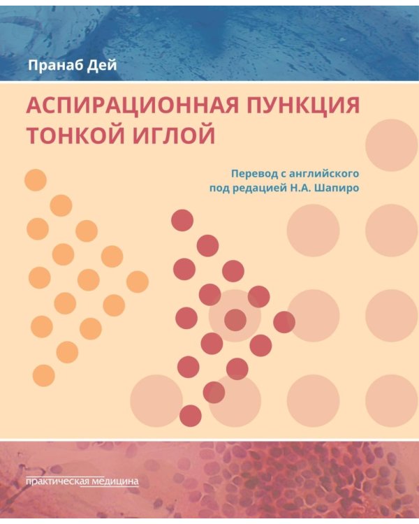 Аспирационная пункция тонкой иглой. Трактовка результатов и диагностические проблемы