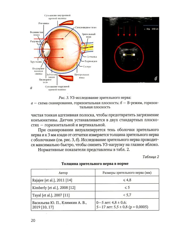 Нейровизуализация при энцефалитах и менингитах у детей