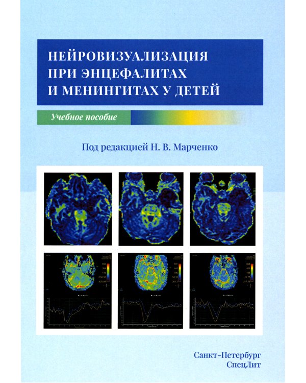 Нейровизуализация при энцефалитах и менингитах у детей