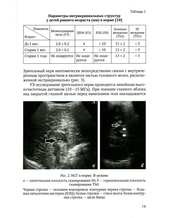 Нейровизуализация при энцефалитах и менингитах у детей