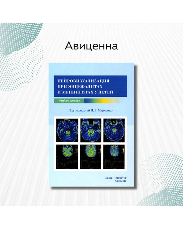 Нейровизуализация при энцефалитах и менингитах у детей