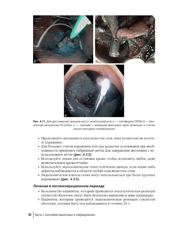 Колоректальная хирургия. Иллюстрированные советы и практические рекомендации