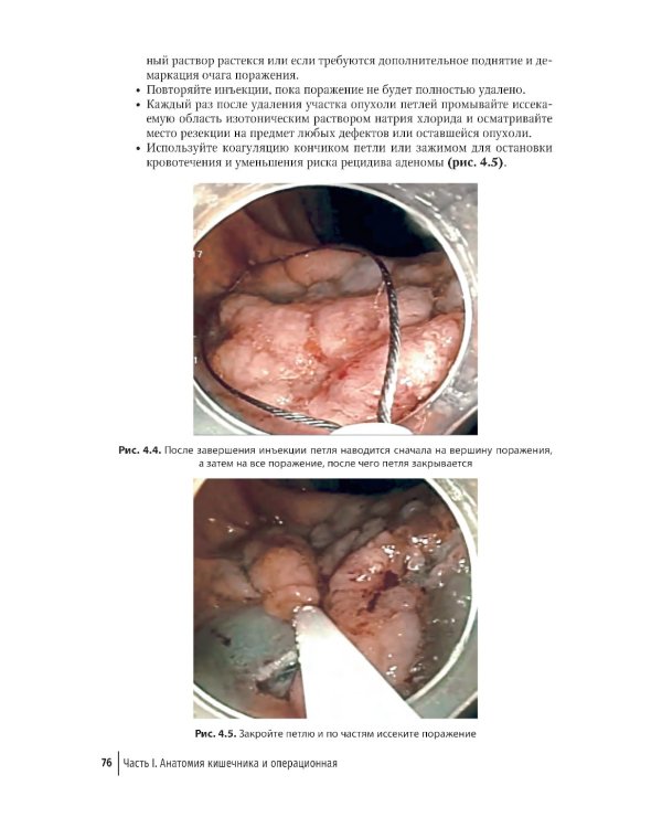 Колоректальная хирургия. Иллюстрированные советы и практические рекомендации