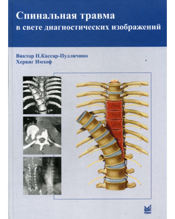 Спинальная травма в свете диагностических изображений