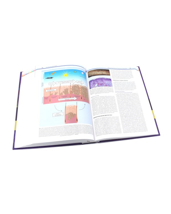 Дерматология по Фицпатрику. В 4 т (комплект)