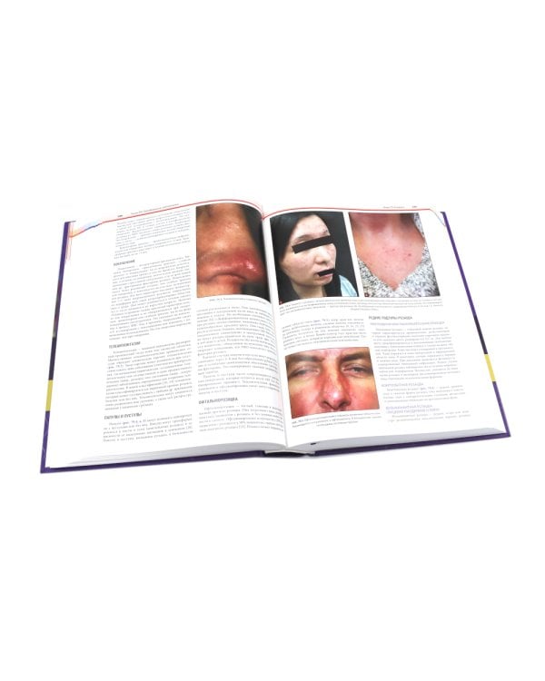 Дерматология по Фицпатрику. В 4 т (комплект)