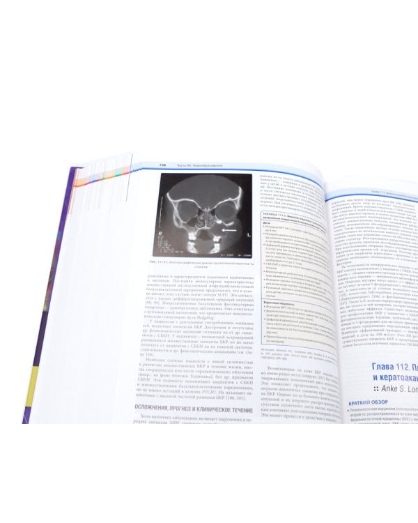 Дерматология по Фицпатрику. В 4 т (комплект)